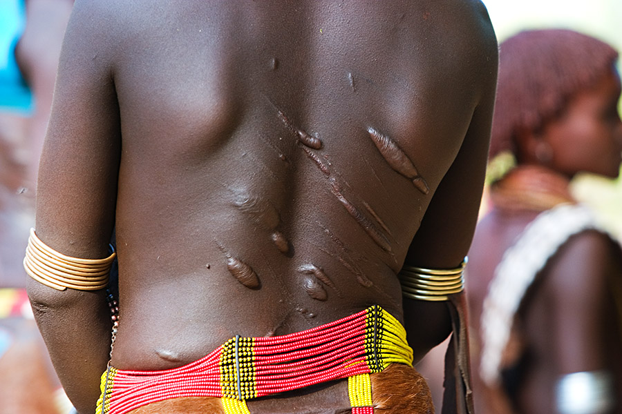 43   Hamar   Old scars as result of whipping of the woman before bull jump ceremony